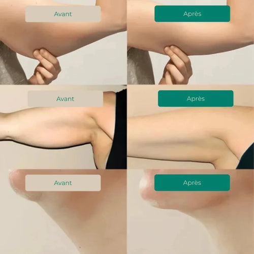 DRAINANT LYMPHATIQUE