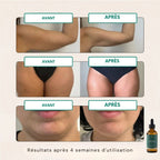 DRAINANT LYMPHATIQUE